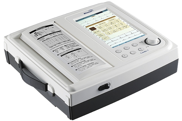 electrocardiogram